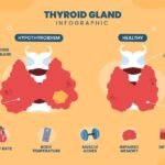 Thyroid infographic