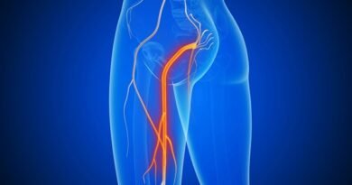 सायटिका का ‘नेचुरल’ इलाज: योग, एक्यूप्रेशर और व्यायाम से पाएं दर्द में राहत