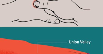 LI4 (Hegu) Acupressure Point: सिरदर्द और दर्द से तुरंत राहत